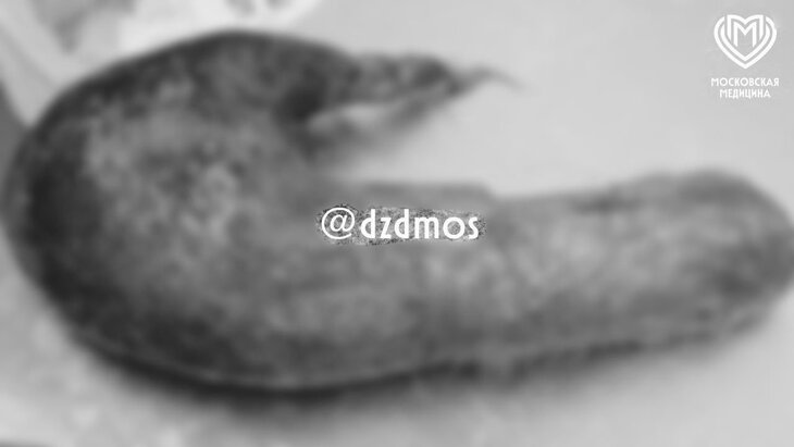 ���������� ����� ������� �� ������� 17-������ ������� ���������� ��� �����