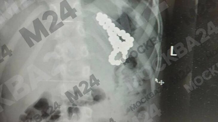 ���������� ������� ������ ���������, ������������ 46 ��������� �������