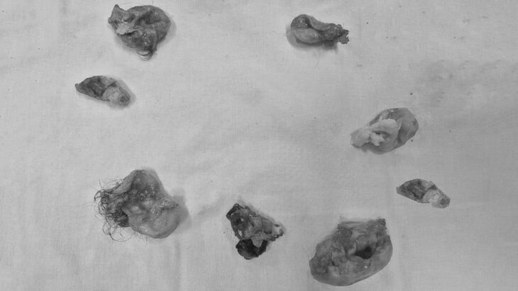 ����� � ����������� ������� � ������� 8 ���� � �������� � ����� ������