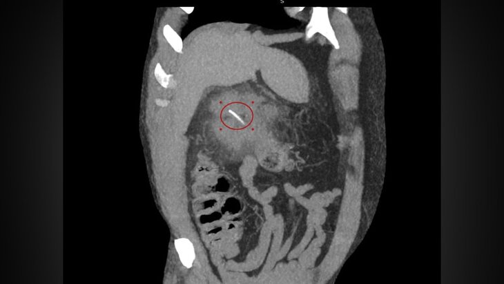 ������������ ����� ������ �������, �������� ����� ����� ��������� ��������